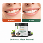Bhumi Organic Coconut Charcoal Teeth Whitening Powder | Natural Stain Removal | 100g